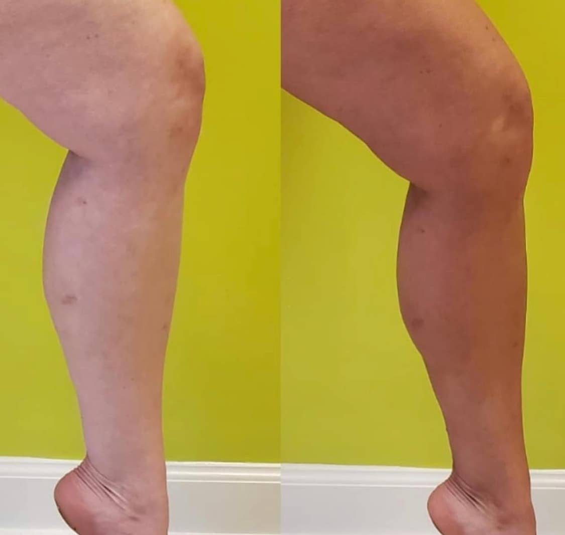 Beettan Sunless Tan Mousse | Medium dark